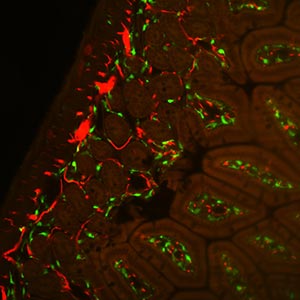 Neuroimmunology